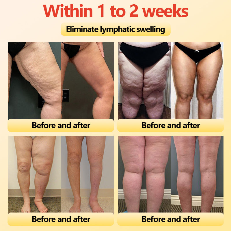 Final 3Hours: 80% OFF 🔥 Neslemy™ Titanium Fiber Self-heating Tourmaline Shaping Shorts