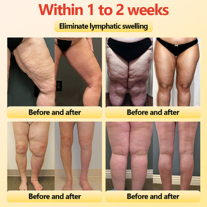 Final 3Hours: 80% OFF 🔥 Neslemy™ Titanium Fiber Self-heating Tourmaline Shaping Shorts