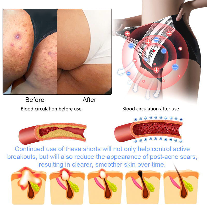 Final 3Hours: 80% OFF 🔥 Neslemy™ Titanium Fiber Self-heating Tourmaline Shaping Shorts