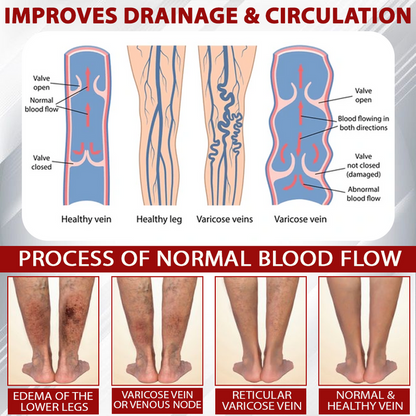 MOONBIFFY 360° Calf MASSAGER
