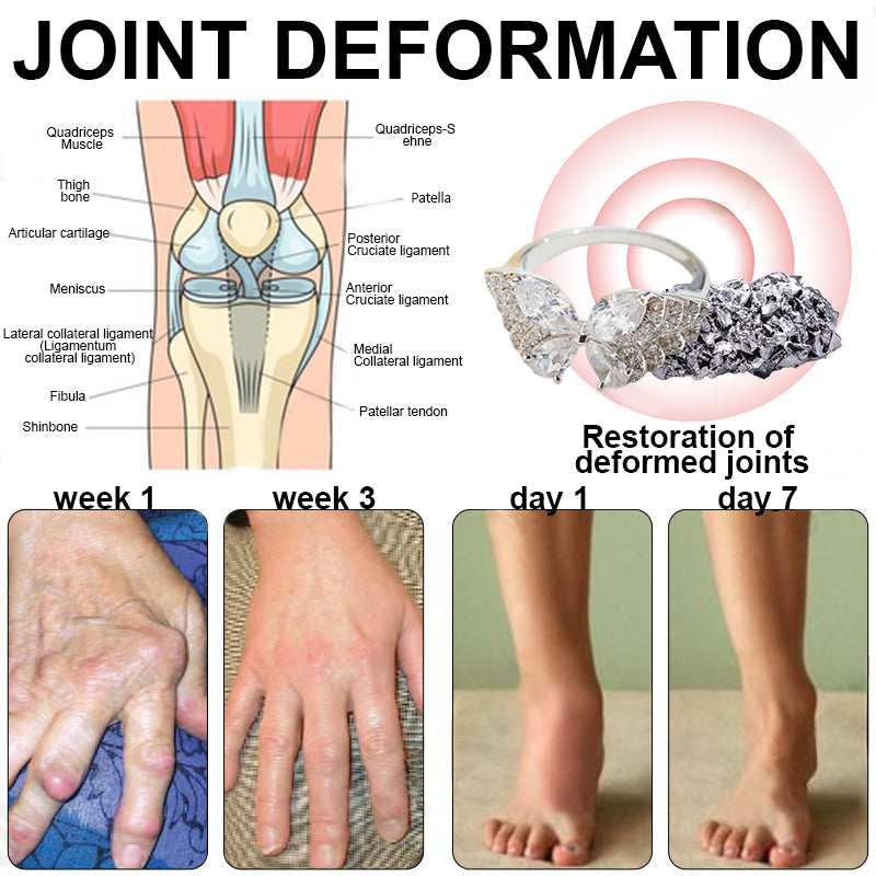 Phantom butterfly ring🔥 🔥🔥