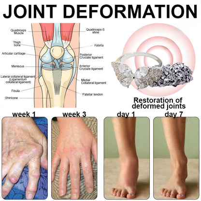 Phantom butterfly ring🔥 🔥🔥