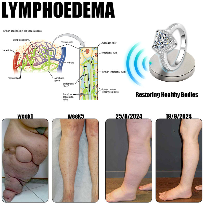 🔥✨🩵𝐋𝐚𝐬𝐭 𝐃𝐚𝐲 𝐃𝐢𝐬𝐜𝐨𝐮𝐧𝐭: 87% 𝐎𝐅𝐅🔥Histone™ Lymphatic Magnetic Therapy Heart Ring