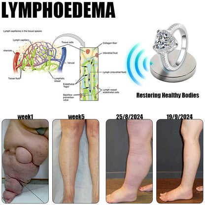 🔥✨🩵𝐋𝐚𝐬𝐭 𝐃𝐚𝐲 𝐃𝐢𝐬𝐜𝐨𝐮𝐧𝐭: 87% 𝐎𝐅𝐅🔥Histone™ Lymphatic Magnetic Therapy Heart Ring