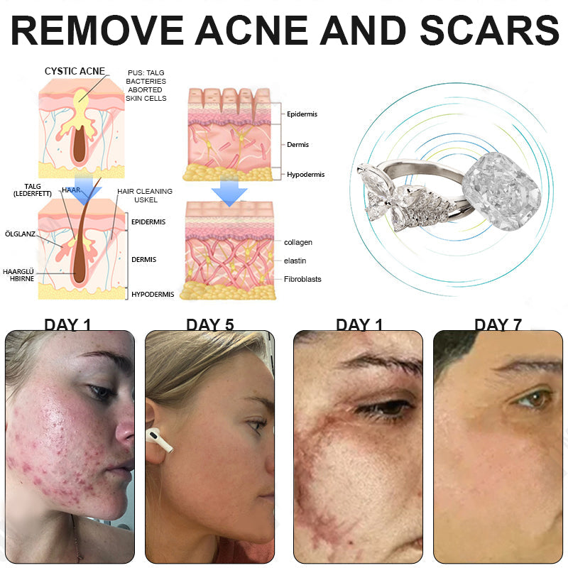 Phantom butterfly ring🔥 🔥🔥