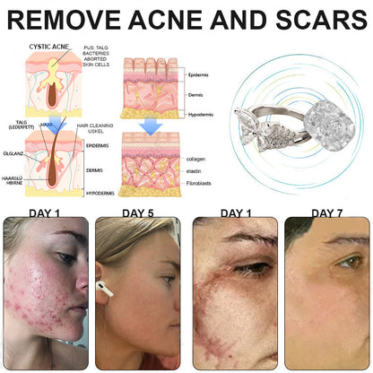 Phantom butterfly ring🔥 🔥🔥