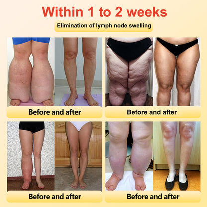 🔥✨🩵𝐋𝐚𝐬𝐭 𝐃𝐚𝐲 𝐃𝐢𝐬𝐜𝐨𝐮𝐧𝐭: 87% 𝐎𝐅𝐅🔥Histone™ Lymphatic Magnetic Therapy Heart Ring