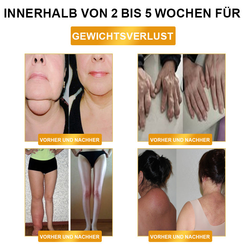 ✅BSI-certification |⚡LOVILDS™ Ultrasonic Fat Blasting ＆ Far Infrared Blood Sugar Balancing Detox Wristband (🔥LAST DAY 70% OFF)