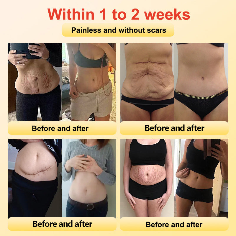 🔥✨🩵𝐋𝐚𝐬𝐭 𝐃𝐚𝐲 𝐃𝐢𝐬𝐜𝐨𝐮𝐧𝐭: 87% 𝐎𝐅𝐅🔥Histone™ Lymphatic Magnetic Therapy Heart Ring