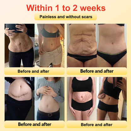 🔥✨🩵𝐋𝐚𝐬𝐭 𝐃𝐚𝐲 𝐃𝐢𝐬𝐜𝐨𝐮𝐧𝐭: 87% 𝐎𝐅𝐅🔥Histone™ Lymphatic Magnetic Therapy Heart Ring