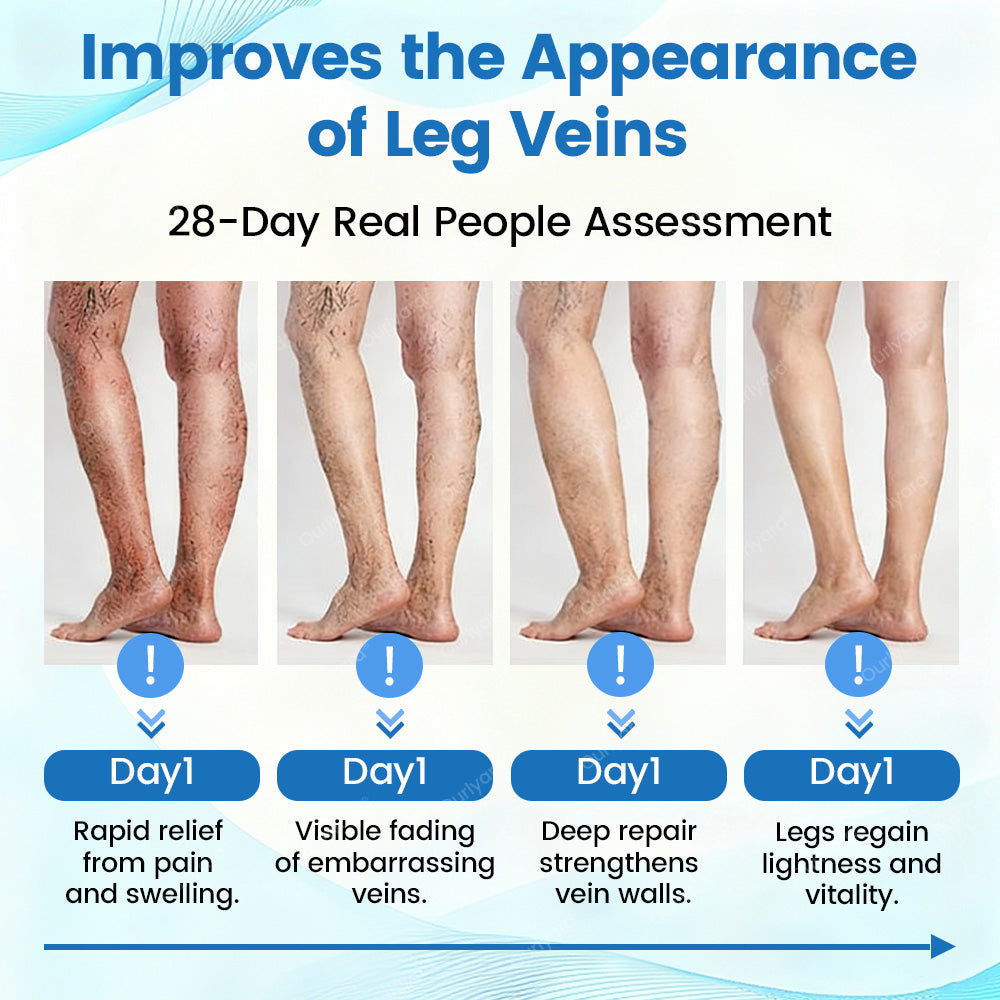 🇬🇧✅✅Ourlyard® VascuCare Vein Healing Spray(Designed for Varicose veins, Spider veins, Deep vein Thrombosis, Chronic venous insufficiency, Venous ulcers, Thrombophlebitis and other venous issues)