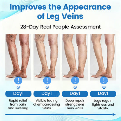 🇬🇧✅✅Ourlyard® VascuCare Vein Healing Spray(Designed for Varicose veins, Spider veins, Deep vein Thrombosis, Chronic venous insufficiency, Venous ulcers, Thrombophlebitis and other venous issues)