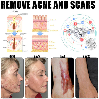 🔥✨🩵𝐋𝐚𝐬𝐭 𝐃𝐚𝐲 𝐃𝐢𝐬𝐜𝐨𝐮𝐧𝐭: 87% 𝐎𝐅𝐅🔥Histone™ Lymphatic Magnetic Therapy Heart Ring