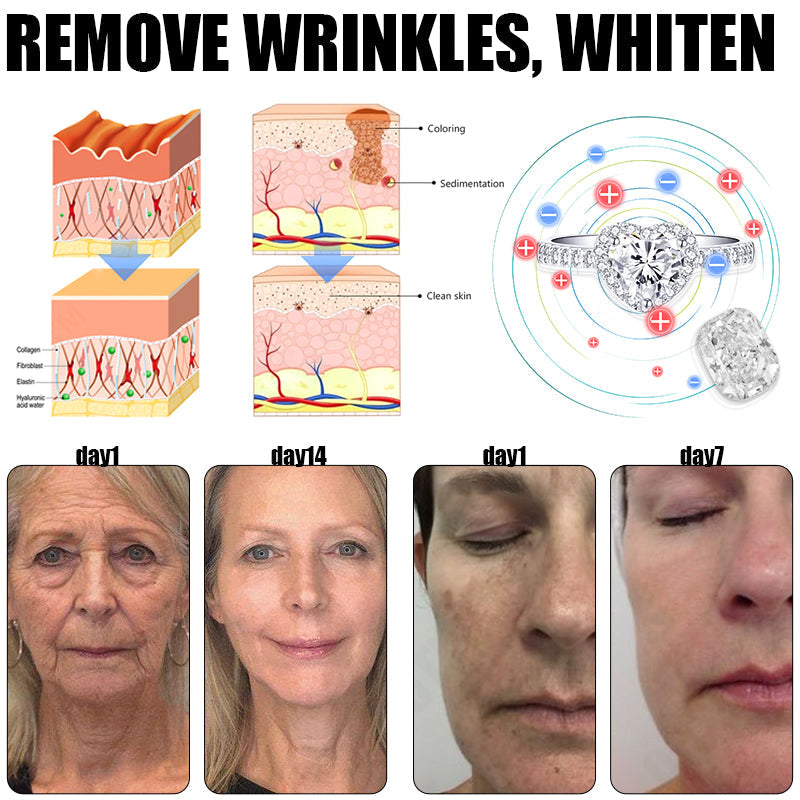 🔥✨🩵𝐋𝐚𝐬𝐭 𝐃𝐚𝐲 𝐃𝐢𝐬𝐜𝐨𝐮𝐧𝐭: 87% 𝐎𝐅𝐅🔥Histone™ Lymphatic Magnetic Therapy Heart Ring