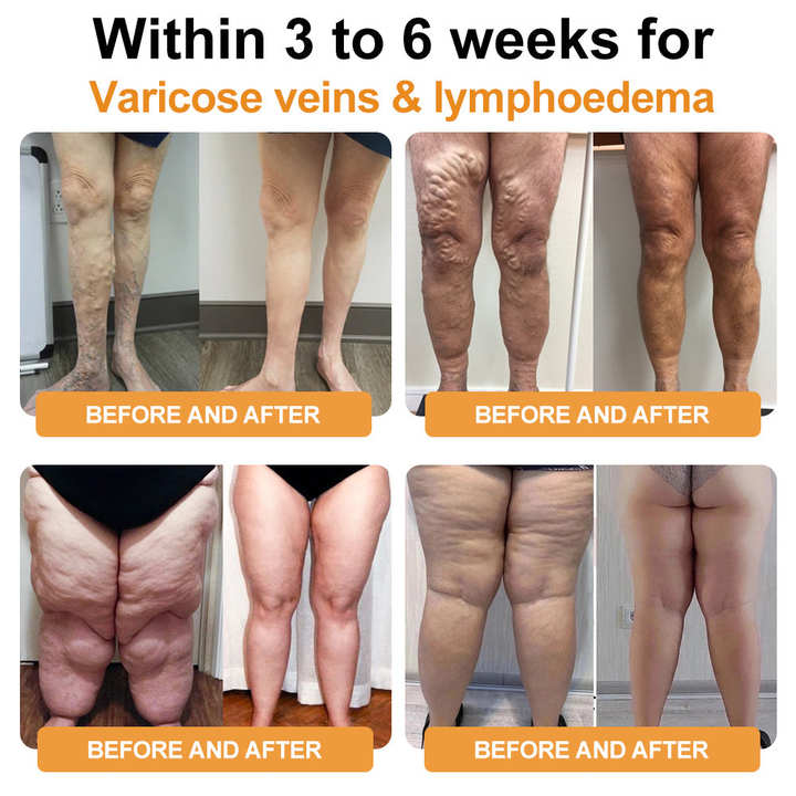 ✅BSI-certification |⚡LOVILDS™ Ultrasonic Fat Blasting ＆ Far Infrared Blood Sugar Balancing Detox Wristband (🔥LAST DAY 70% OFF)