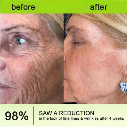 🧠👨‍⚕️Made and shipped from the USA 💫Lovilds® Botin & Vita-A Retinol Shot Wrinkle-Lift Tightening cream - Last Day Promotion 70% OFF