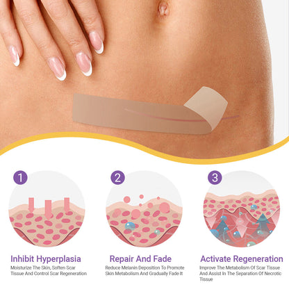 ✅Official Store | Oveallgo® Hyaluronic Acid Nano Microneedle Repair Tape🏥(Treatment of old and new scars, reduction of surgical scars, stretch marks, keloids, acne, burns, warts, dermatomes and varicose veins)