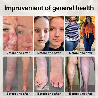 Phantom butterfly ring🔥 🔥🔥