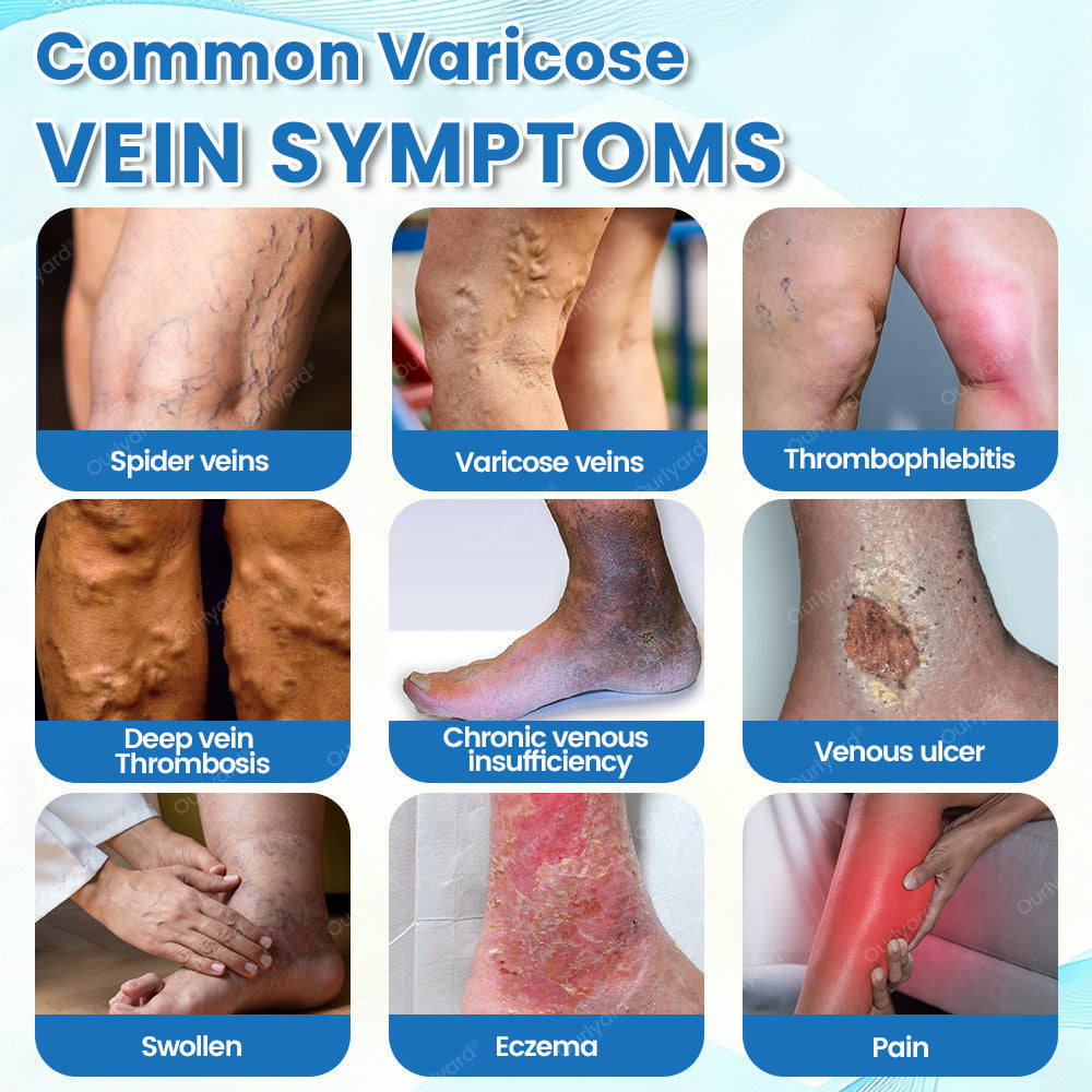 🇬🇧✅✅Ourlyard® VascuCare Vein Healing Spray(Designed for Varicose veins, Spider veins, Deep vein Thrombosis, Chronic venous insufficiency, Venous ulcers, Thrombophlebitis and other venous issues)