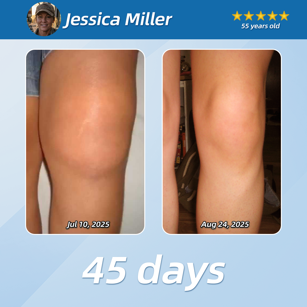 【𝑶𝒇𝒇𝒊𝒄𝒊𝒂𝒍 𝑺𝒕𝒐𝒓𝒆 】us LOVILDS Pain Relief& Repair Lotion✔️For Muscle, Joint & Nerve Pain