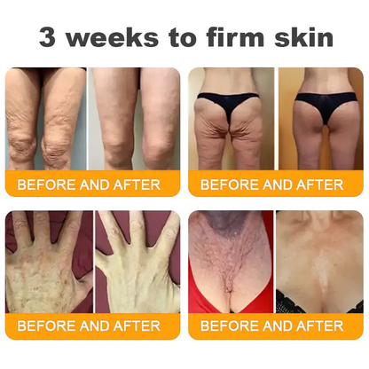 Made and Shipped from USA ✨ Cheemex® Bee Toxin Skin Restoration Cream ⏰ LAST DAY 80% OFF✨✨