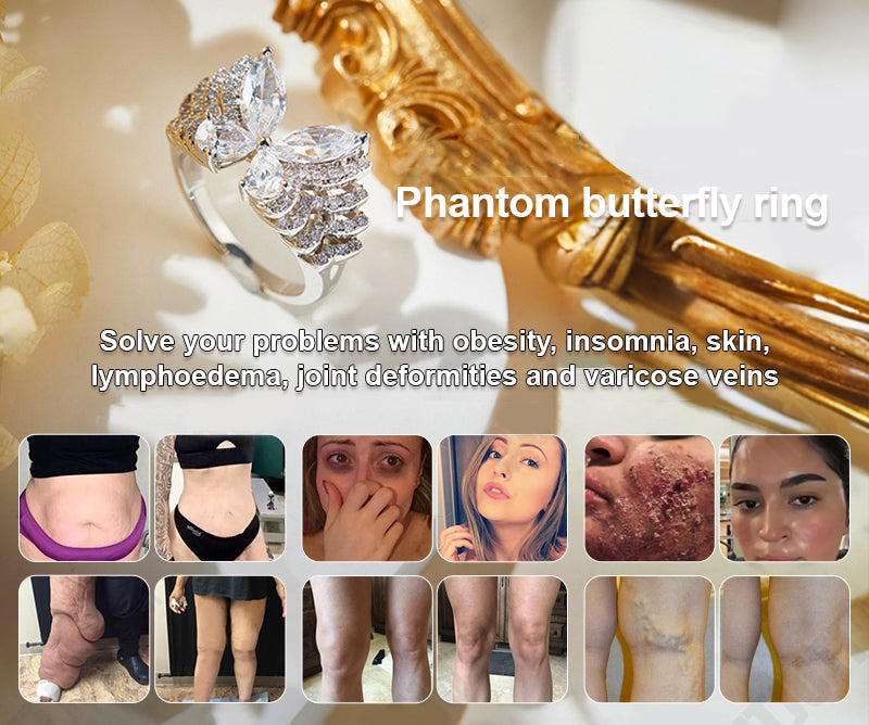 Phantom butterfly ring🔥 🔥🔥