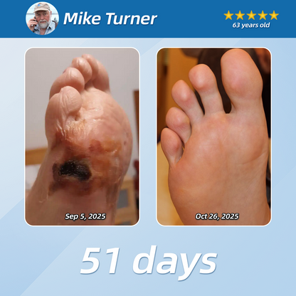 【𝑶𝒇𝒇𝒊𝒄𝒊𝒂𝒍 𝑺𝒕𝒐𝒓𝒆 】us LOVILDS Pain Relief& Repair Lotion✔️For Muscle, Joint & Nerve Pain