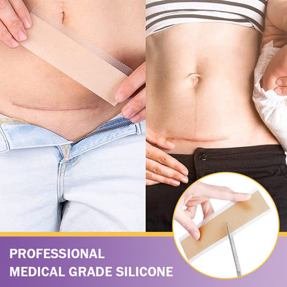 ✅Official Store | Oveallgo® Hyaluronic Acid Nano Microneedle Repair Tape🏥(Treatment of old and new scars, reduction of surgical scars, stretch marks, keloids, acne, burns, warts, dermatomes and varicose veins)