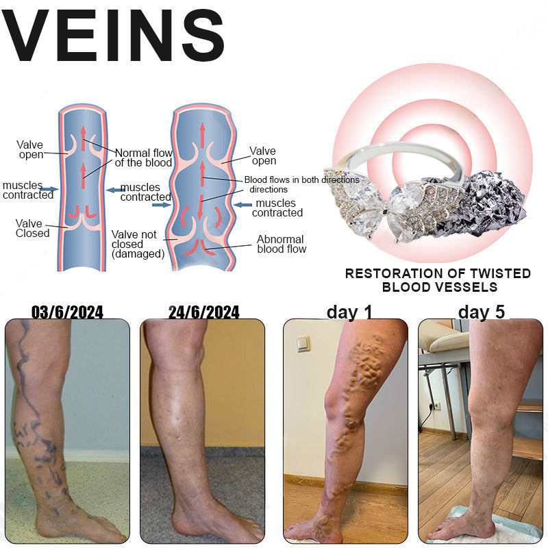 Phantom butterfly ring🔥 🔥🔥