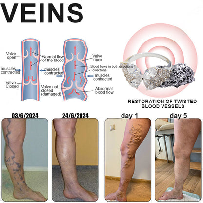 Phantom butterfly ring🔥 🔥🔥