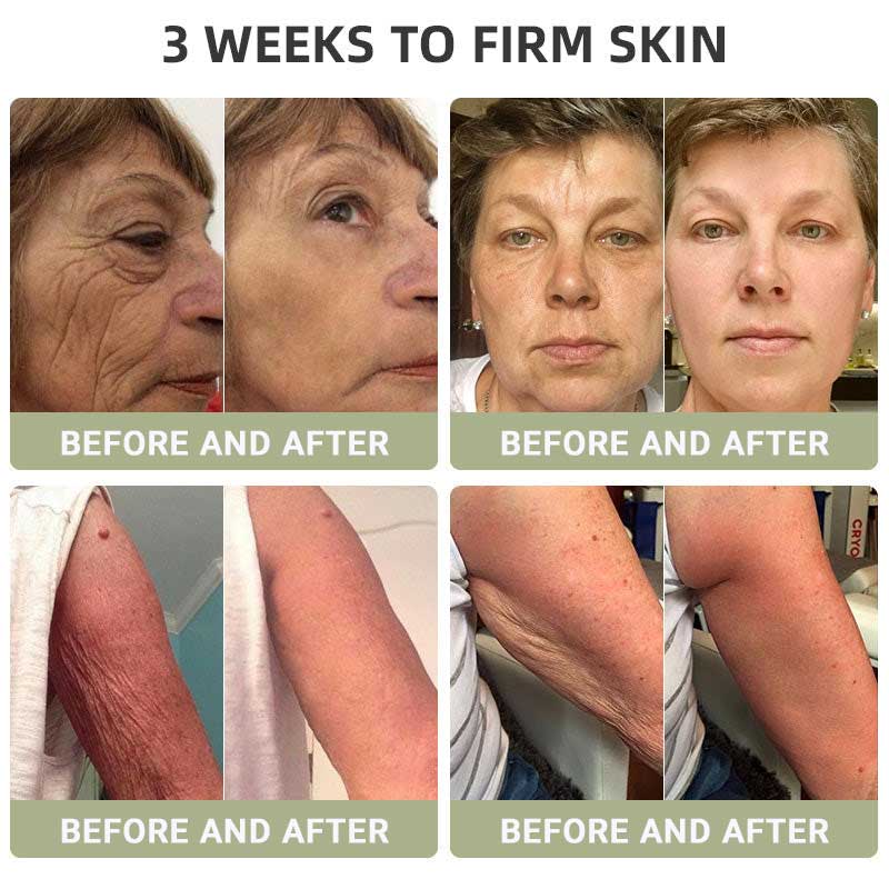 🌿HZA™ Luxurious Collagen Firming Cream(🔥LAST DAY 80% OFF)