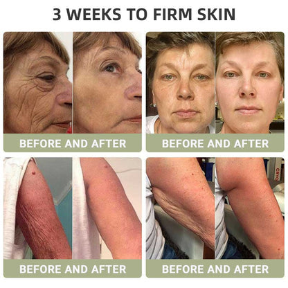 🌿HZA™ Luxurious Collagen Firming Cream(🔥LAST DAY 80% OFF)