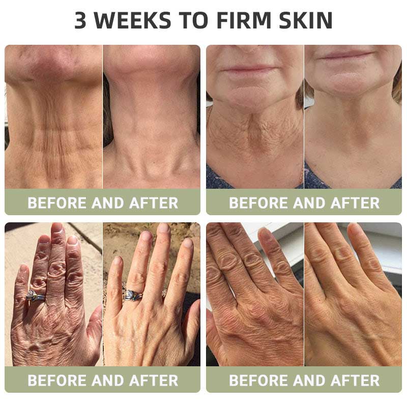 🌿HZA™ Luxurious Collagen Firming Cream(🔥LAST DAY 80% OFF)