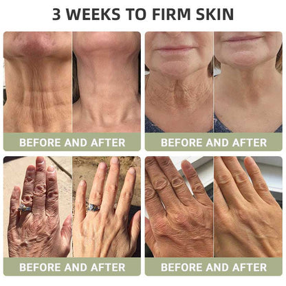 🌿HZA™ Luxurious Collagen Firming Cream(🔥LAST DAY 80% OFF)