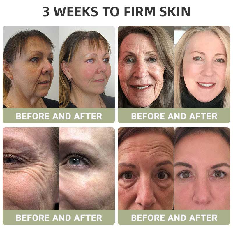 🌿HZA™ Luxurious Collagen Firming Cream(🔥LAST DAY 80% OFF)