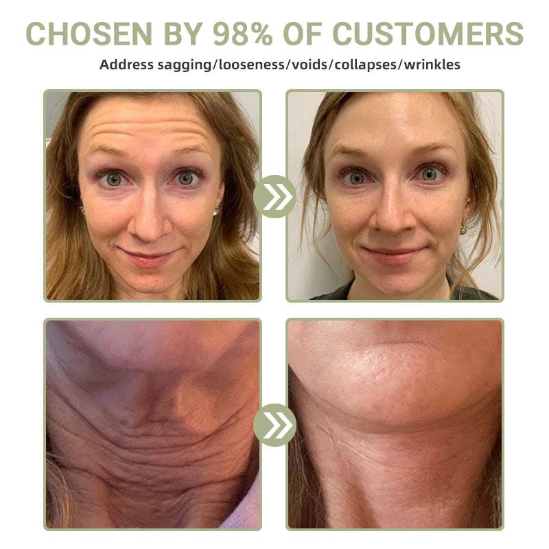 🌿HZA™ Luxurious Collagen Firming Cream(🔥LAST DAY 80% OFF)