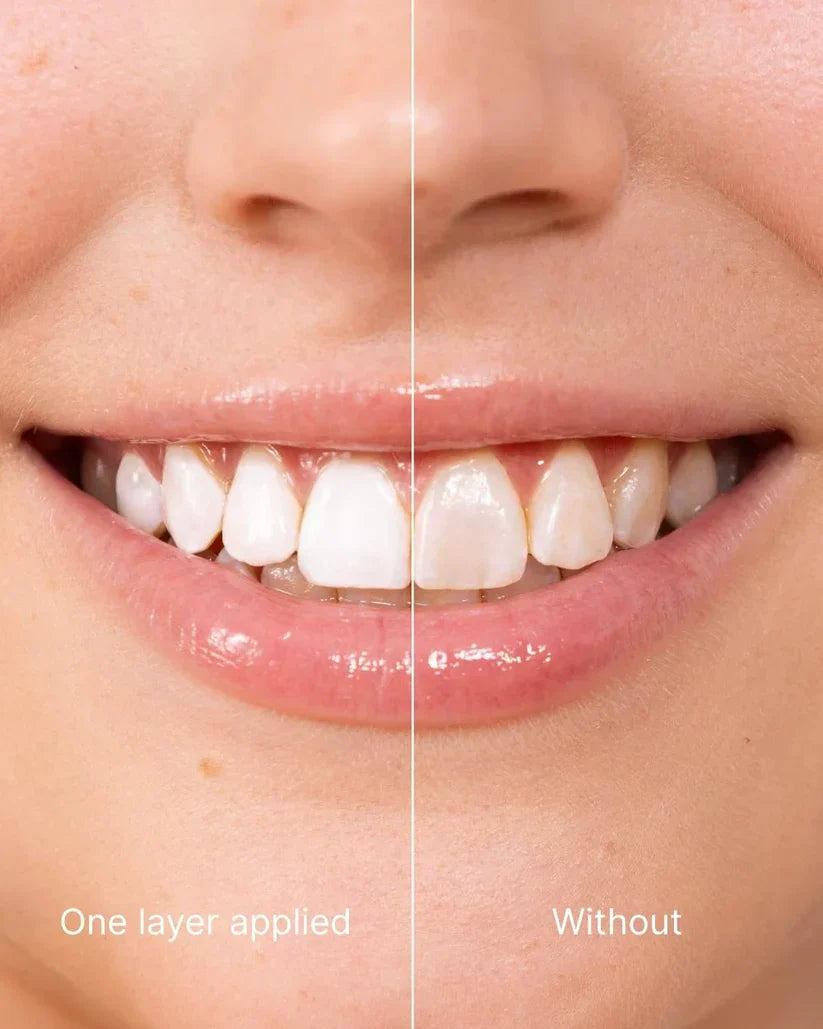 💎LOVILDS™ – Long-Lasting, Natural-Looking Teeth Color. Flash Sale: Up to 65% OFF!