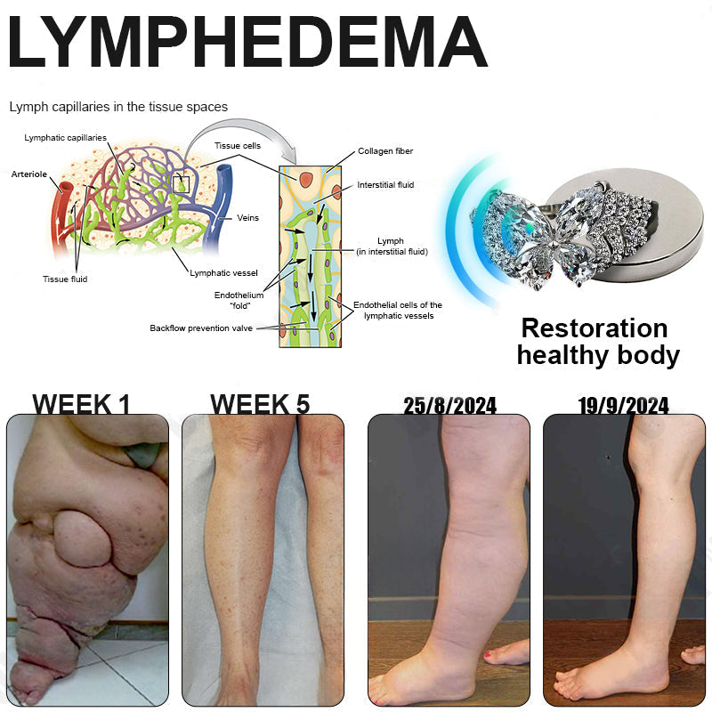 Phantom butterfly ring🔥 🔥🔥