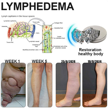 Phantom butterfly ring🔥 🔥🔥