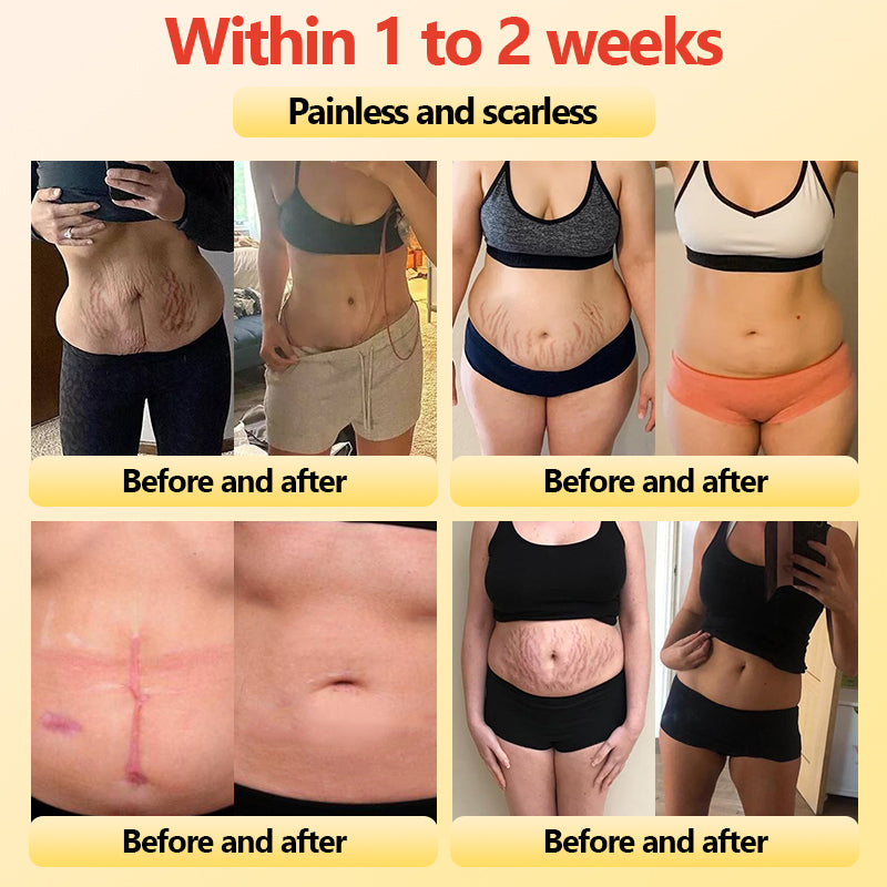 Final 3Hours: 80% OFF 🔥 Neslemy™ Titanium Fiber Self-heating Tourmaline Shaping Shorts