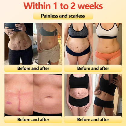 Final 3Hours: 80% OFF 🔥 Neslemy™ Titanium Fiber Self-heating Tourmaline Shaping Shorts