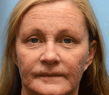 🧠👨‍⚕️Made and shipped from the USA 💫Lovilds® Botin & Vita-A Retinol Shot Wrinkle-Lift Tightening cream - Last Day Promotion 70% OFF