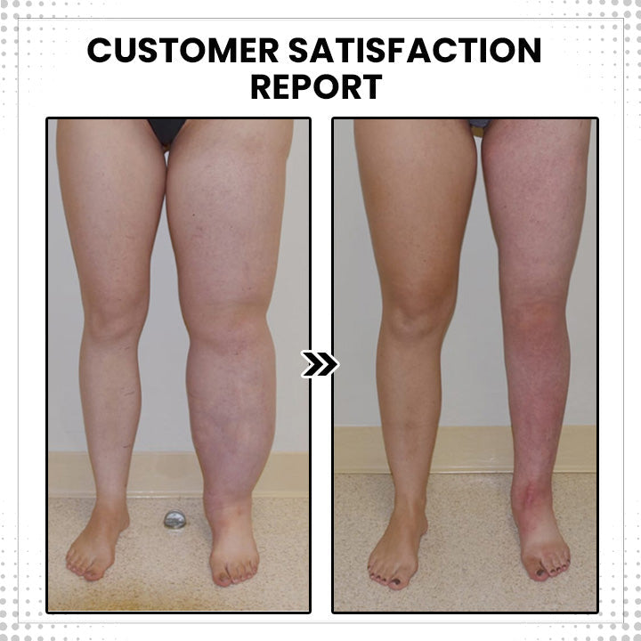 Histone™Thermotherapeutic Body Detox Ring(Limited time discount 🔥 last day)