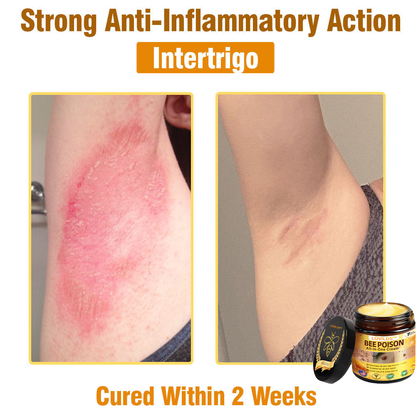 LOVILDS™ Bee Poison All-in-One Cream US Dermatologist Approved